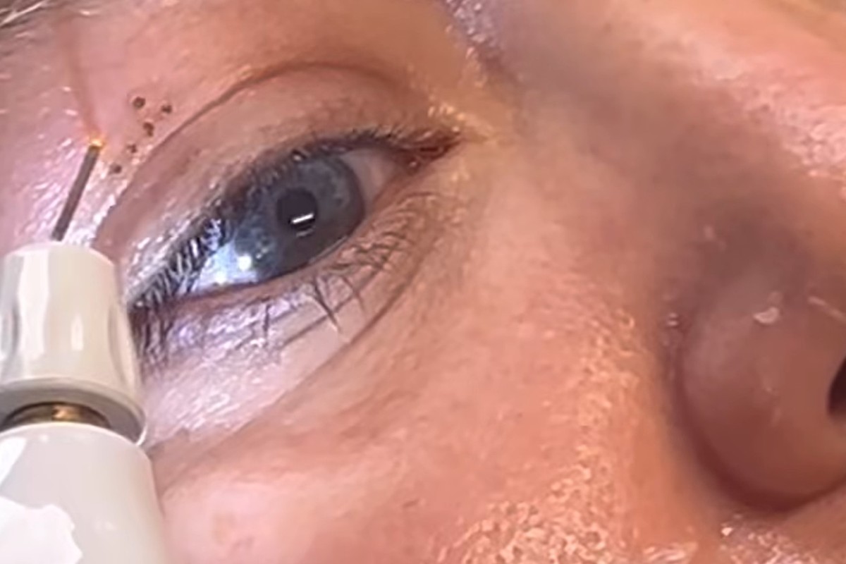 Sublime Aesthetic Medicine Videos